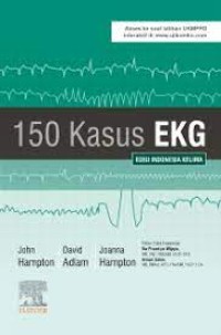 150 kasus EKG