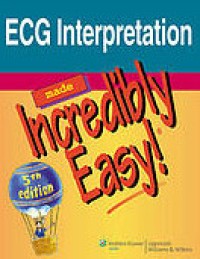 ECG interpretation made incredibly easy!