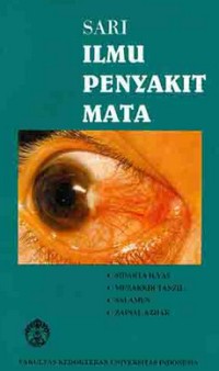 Sari ilmu penyakit mata