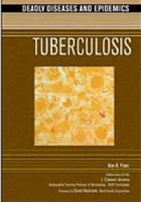 Tuberculosis